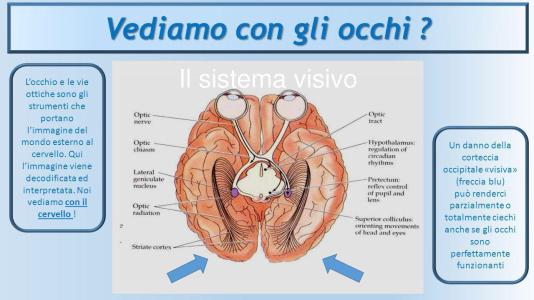 vediamo con il cervello